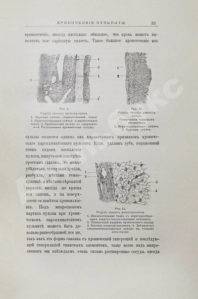 Антикварная книга Звержховский, Ф.А. Основы дентиатрии. Руководство для врачей и студентов — , 1911-1912 дополнительное фото 14