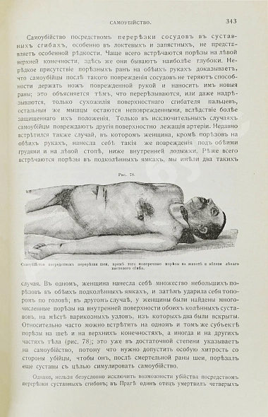 Антикварная книга Гофман, Э.Р. фон. Учебник судебной медицины — Гофман Эдуард Риттер фон, 1912 дополнительное фото 4