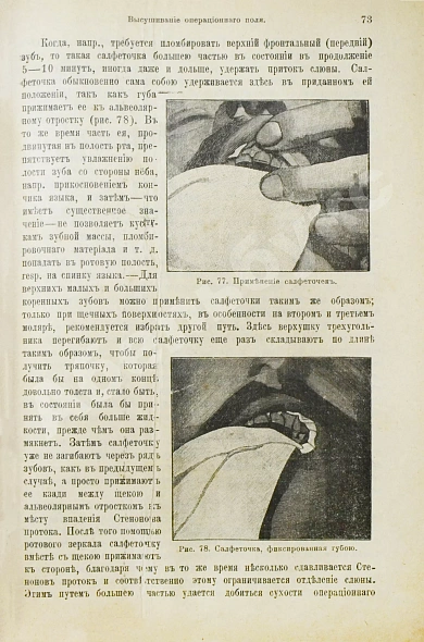 Антикварная книга Миллер, У.Д. Руководство консервативного зубоврачевания — , 1898 дополнительное фото 6