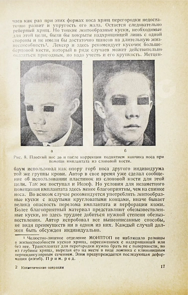 Антикварная книга Эйтнер, Э. Косметические операции. Краткое руководство для врачей — , 1936 дополнительное фото 5