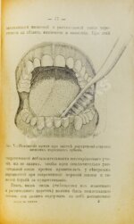 Тубянский, Д.М. Уход за зубами