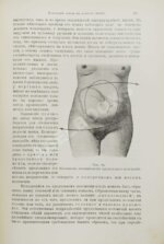 Бумм, Э. Руководство к изучению акушерства в двадцати восьми лекциях