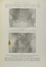 Бумм, Э. Руководство к изучению акушерства в двадцати восьми лекциях