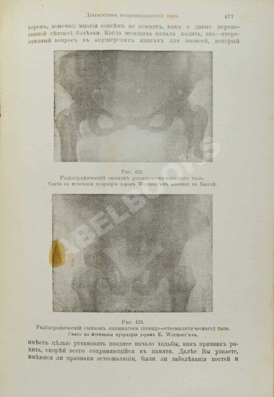 Антикварная книга Бумм, Э. Руководство к изучению акушерства в двадцати восьми лекциях