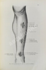 Кохер, Т. Учение о хирургических операциях д-ра Т. Кохера