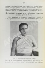 Бертенсон, Л.Б., Никольский, Д.П. Краткое руководство по поданию первой помощи при несчастных случаях и внезапных заболеваниях