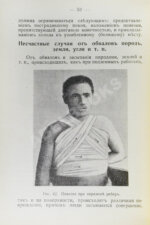 Бертенсон, Л.Б., Никольский, Д.П. Краткое руководство по поданию первой помощи при несчастных случаях и внезапных заболеваниях
