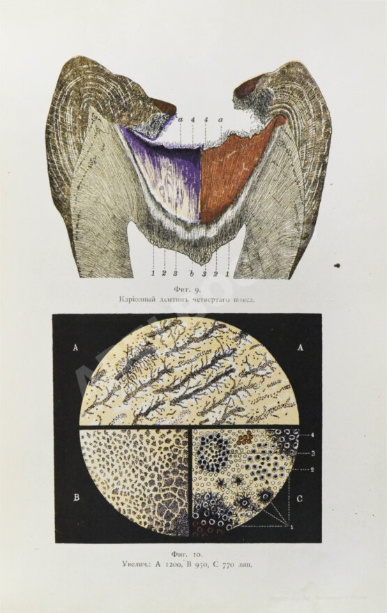 Антикварная книга Руководство к лечению зубных болезней