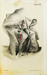 Пирогов, Н.И. Хирургическая анатомия артериальных стволов и фасций