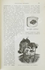 Гофман, Э.Р. фон. Учебник судебной медицины