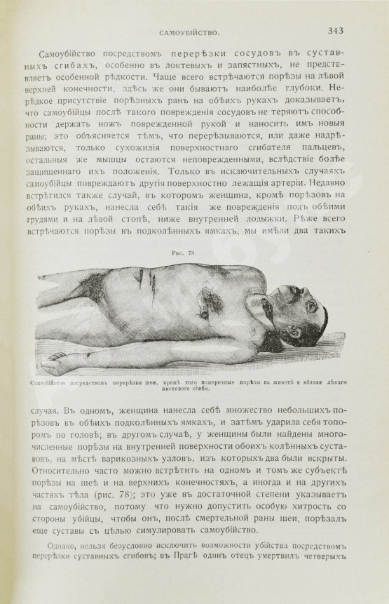 Гофман, Э.Р. фон. Учебник судебной медицины