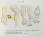 Мейер, Б. Первая помощь в несчастных случаях