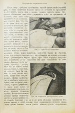 Миллер, У.Д. Руководство консервативного зубоврачевания