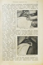 Миллер, У.Д. Руководство консервативного зубоврачевания