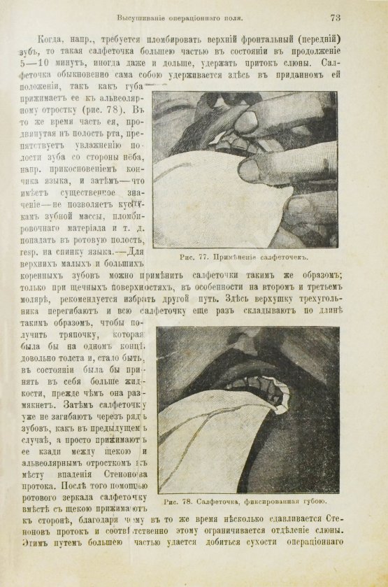 Антикварная книга Миллер, У.Д. Руководство консервативного зубоврачевания