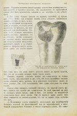 Миллер, У.Д. Руководство консервативного зубоврачевания