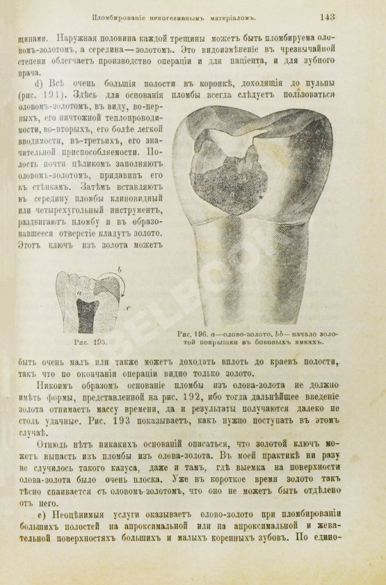Антикварная книга Миллер, У.Д. Руководство консервативного зубоврачевания