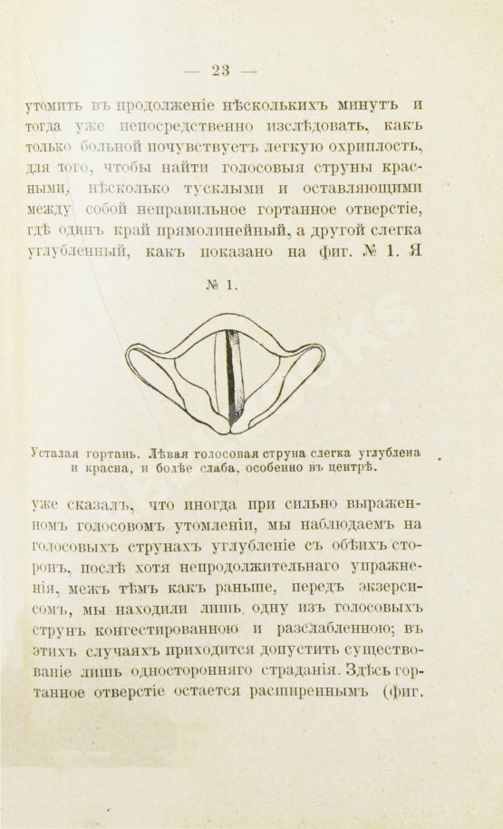 Антикварная книга Ботей, Р. Болезни голоса у певцов и их лечение