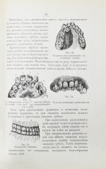 Фишер, А.В. Зубы, их значение и необходимые мероприятия к сохранению их