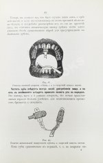 Фишер, А.В. Зубы, их значение и необходимые мероприятия к сохранению их