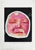 Грифф, К.Р. Атлас наружных заболеваний глаза для врачей и студентов