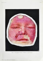 Грифф, К.Р. Атлас наружных заболеваний глаза для врачей и студентов