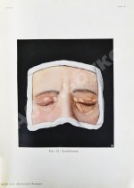 Грифф, К.Р. Атлас наружных заболеваний глаза для врачей и студентов