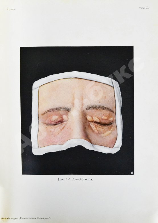 Грифф, К.Р. Атлас наружных заболеваний глаза для врачей и студентов