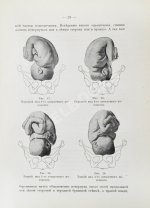Побединский, Н.И. Краткий учебник акушерства