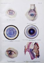 Рёмер, П. Руководство по глазным болезням