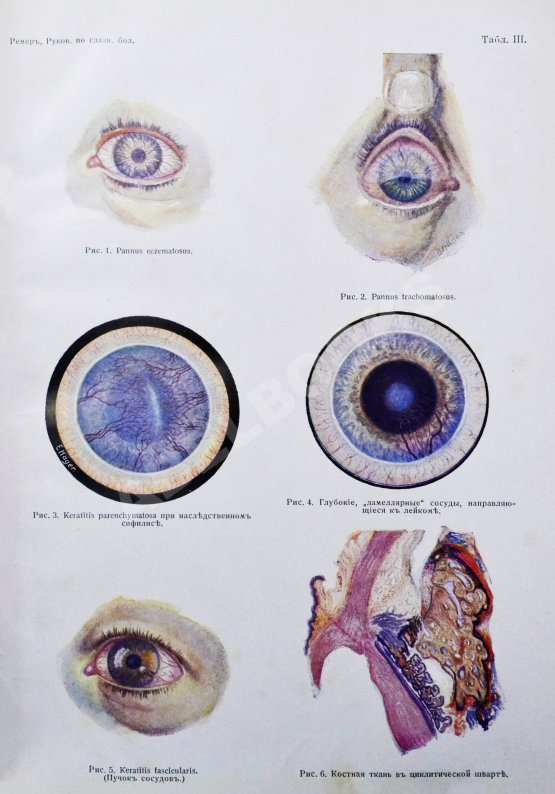 Антикварная книга Рёмер, П. Руководство по глазным болезням