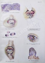 Рёмер, П. Руководство по глазным болезням