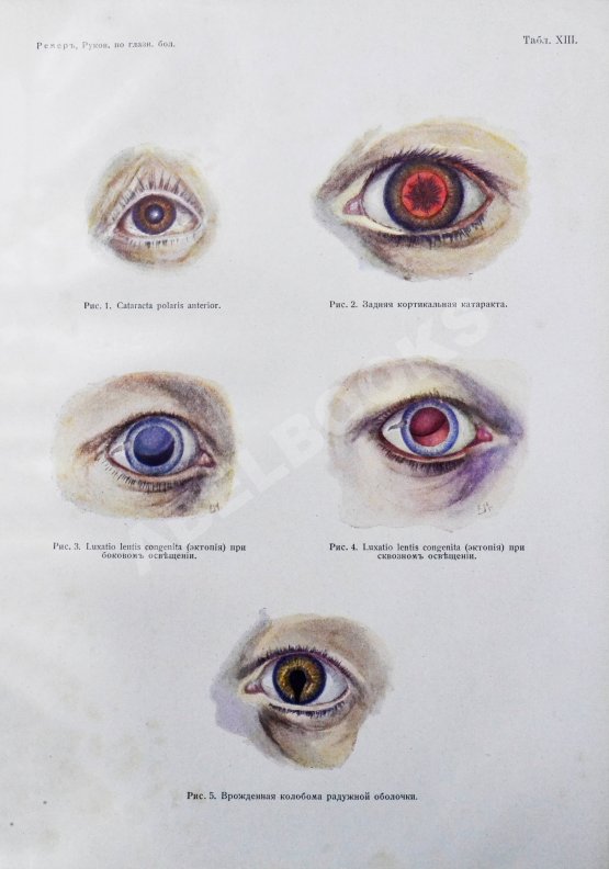 Антикварная книга Рёмер, П. Руководство по глазным болезням