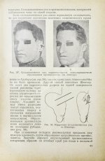 Эйтнер, Э. Косметические операции. Краткое руководство для врачей