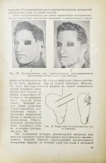 Эйтнер, Э. Косметические операции. Краткое руководство для врачей