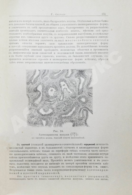 Антикварная книга Шмаус, Г. Основы патологической анатомии