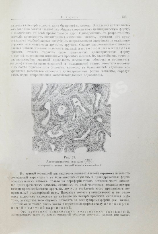 Антикварная книга Шмаус, Г. Основы патологической анатомии